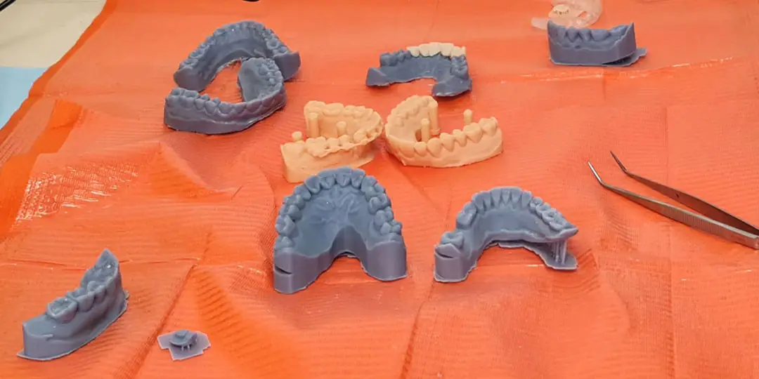 Trabajos de impresión en Clínica dental Fuset en Valencia.